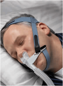sindrome apena obstructiva del sueño
